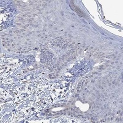 MPP1 Rabbit anti-Human, Polyclonal, Novus Biologicals:Antibodies:Primary