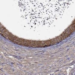 MPP2 Rabbit anti-Human, Polyclonal, Novus Biologicals 25 &mu;g; Unconjugated:Antibodies,