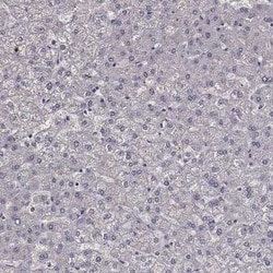 MPP2 Rabbit anti-Human, Polyclonal, Novus Biologicals 25 &mu;g; Unconjugated:Antibodies,