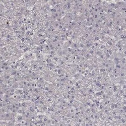 MPP2 Rabbit anti-Human, Polyclonal, Novus Biologicals 25 &mu;g; Unconjugated:Antibodies,