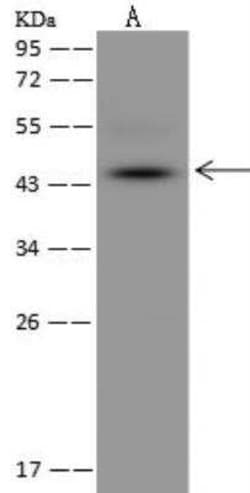 MPPE1 Antibody, Novus Biologicals 100 &mu;g; Unconjugated:Antibodies, Polyclonal