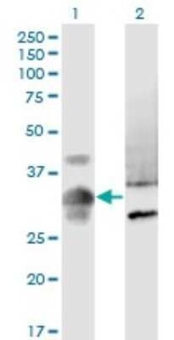 MPPED2 Antibody (4H5), Novus Biologicals 0.1 mg | Buy Online | Novus Biologicals | Fisher Scientific