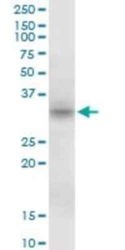 MPST Antibody, Novus Biologicals 0.05 mg | Buy Online | Novus Biologicals | Fisher Scientific