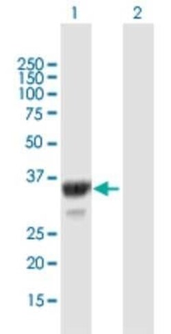 MPST Antibody, Novus Biologicals 0.05 mg | Buy Online | Novus Biologicals | Fisher Scientific