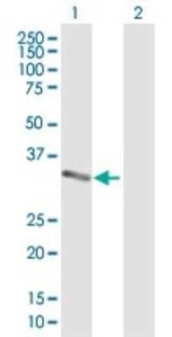 MPZL1 Antibody, Novus Biologicals 0.1 mg | Buy Online | Novus Biologicals | Fisher Scientific