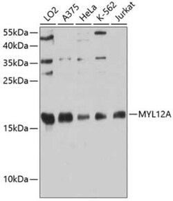 MRCL3 Antibody - Azide and BSA Free, Novus Biologicals 0.02 mL | Buy Online | Novus Biologicals | Fisher Scientific