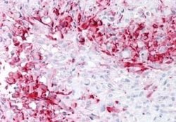 MRGPRD Antibody, Novus Biologicals 50 &mu;g | Buy Online | Novus Biologicals | Fisher Scientific