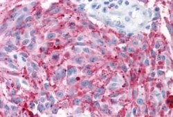 MRGPRD Antibody, Novus Biologicals 50 &mu;g | Buy Online | Novus Biologicals | Fisher Scientific