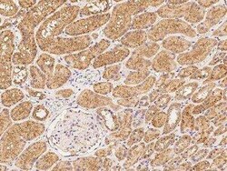 MRM1 Antibody, Novus Biologicals 100 &mu;g | Buy Online | Novus Biologicals | Fisher Scientific