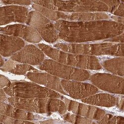 MROH6 Antibody, Novus Biologicals:Antibodies:Primary Antibodies