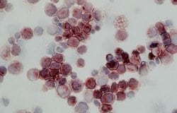 MRP1 Antibody (MRPm6), Novus Biologicals:Antibodies:Primary Antibodies