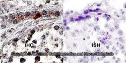 MRP1 Antibody (IU2H10) - BSA Free, Novus Biologicals:Antibodies:Primary