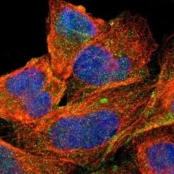 MRP1 Antibody, Novus Biologicals 100 &mu;g; Unconjugated:Antibodies, Polyclonal