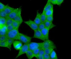 MRP2 Rabbit anti-Human, Clone: JA32-01, Novus Biologicals 100&mu;L:Antibodies,