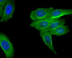 MRP2 Rabbit anti-Human, Clone: JA32-01, Novus Biologicals 100&mu;L:Antibodies,