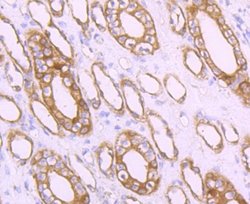 MRP2 Rabbit anti-Human, Clone: JA32-01, Novus Biologicals 100&mu;L:Antibodies,