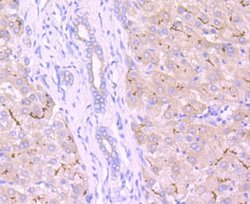 MRP2 Rabbit anti-Human, Clone: JA32-01, Novus Biologicals 100&mu;L:Antibodies,