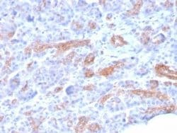 MRP3 Antibody (ABCC3/2971) - Azide and BSA Free, Novus Biologicals 100