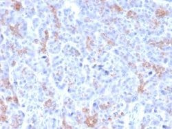 MRP3, Mouse anti-Human, Clone: ABCC3/2971, Novus Biologicals:Antibodies:Primary