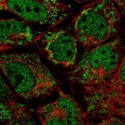 MRPL10 Antibody, Novus Biologicals 25 &mu;L, Unconjugated:Antibodies, Polyclonal