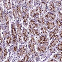 MRPL10 Antibody, Novus Biologicals 25 &mu;L, Unconjugated:Antibodies, Polyclonal