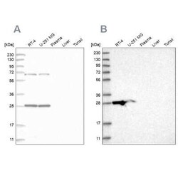 MRPL10 Antibody, Novus Biologicals 25 &mu;L, Unconjugated:Antibodies, Polyclonal