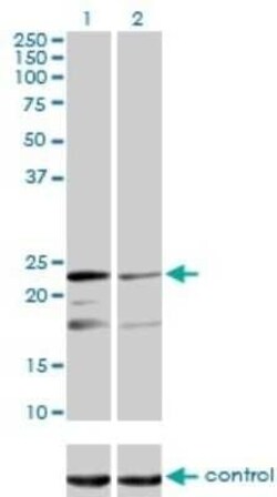MRPL12 Antibody (3B12-1A3), Novus Biologicals 0.1 mg | Buy Online | Novus Biologicals | Fisher Scientific