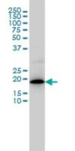 MRPL12 Antibody (3B12-1A3), Novus Biologicals 0.1 mg | Buy Online | Novus Biologicals | Fisher Scientific