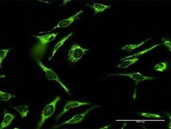Novus Biologicals MRPL12 Antibody, Novus Biologicals 0.1 mg | Buy Online | Novus Biologicals&trade; | Fisher Scientific