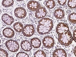 MRPL12 Antibody, Novus Biologicals:Antibodies:Primary Antibodies