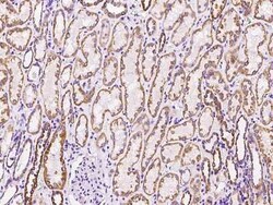MRPL12 Antibody, Novus Biologicals:Antibodies:Primary Antibodies