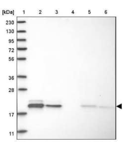 MRPL12 Antibody, Novus Biologicals 0.1 mL; Unconjugated:Antibodies, Polyclonal