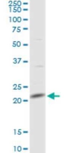 MRPL13 Antibody, Novus Biologicals 0.1 mg | Buy Online | Novus Biologicals | Fisher Scientific