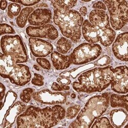MRPL16 Antibody, Novus Biologicals:Antibodies:Primary Antibodies