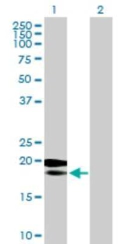 MRPL18 Antibody, Novus Biologicals 0.05 mg, Unconjugated:Antibodies, Polyclonal