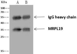 MRPL19 Antibody, Novus Biologicals 50 &mu;g; Unconjugated:Antibodies, Polyclonal