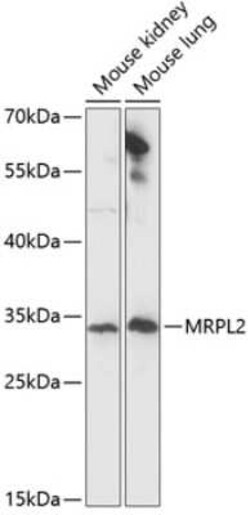 MRPL2 Antibody - Azide and BSA Free, Novus Biologicals 0.1 mL, Unconjugated:Antibodies,