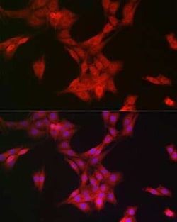 MRPL28 Rabbit anti-Human, Mouse, Rat, Clone: 3B9F2, Novus Biologicals 20