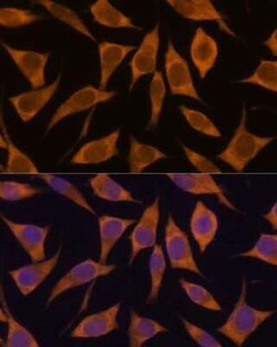 MRPL34 Antibody - Azide and BSA Free, Novus Biologicals 0.1 mL, Unconjugated:Antibodies,