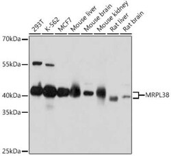 MRPL38 Antibody - Azide and BSA Free, Novus Biologicals:Antibodies:Primary