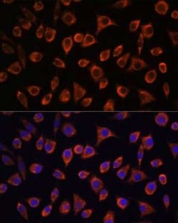 MRPL43 Antibody - Azide and BSA Free, Novus Biologicals 0.02 mL; Unconjugated:Antibodies,