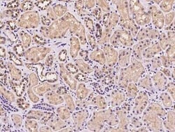 MRPL45 Antibody, Novus Biologicals 100 &mu;g | Buy Online | Novus Biologicals | Fisher Scientific