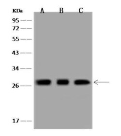 MRPL9 Antibody, Novus Biologicals 50 &mu;g; Unconjugated:Antibodies, Polyclonal