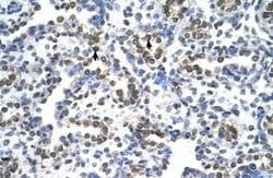 MRPS15 Antibody, Novus Biologicals 100 &mu;L | Buy Online | Novus Biologicals | Fisher Scientific