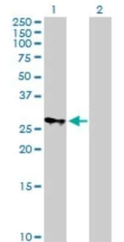 MRPS18B Antibody, Novus Biologicals 0.05 mg | Buy Online | Novus Biologicals | Fisher Scientific