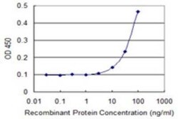 MRPS22 Antibody (1E1), Novus Biologicals 0.1 mg | Buy Online | Novus Biologicals | Fisher Scientific