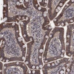 MRPS24 Rabbit anti-Human, Polyclonal, Novus Biologicals 25 &mu;g; Unconjugated:Antibodies,