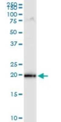 MRPS25 Antibody (3E6), Novus Biologicals 0.1 mg; Unconjugated:Antibodies,