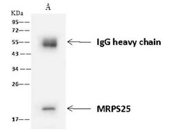 MRPS25 Antibody, Novus Biologicals 50 &mu;g, Unconjugated:Antibodies, Polyclonal