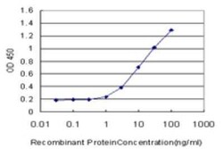 MRPS27 Antibody (1G3), Novus Biologicals 0.1 mg | Buy Online | Novus Biologicals | Fisher Scientific